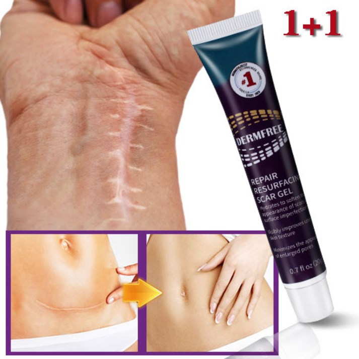 DERMFREE 흉터연고 여드름흉터 수술흉터 화상물집 쌍꺼풀흉터 제왕절개흉터 흉터제거연고 재생크림, 2개, 20ml