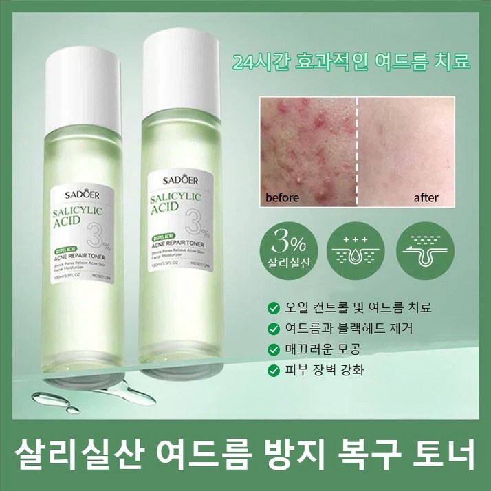 살리실산 여드름 방지 복구 토너 피부 모공 타이트닝 여드름 개선 보습 토너, 5개, 100ml